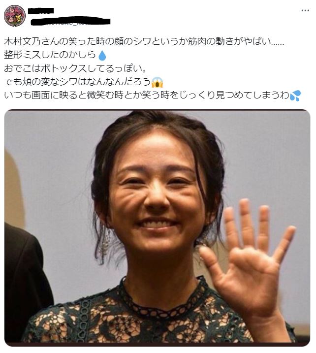 木村文乃の顔のシワが気になるに関するツイート